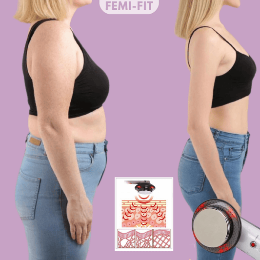 SlimShape – 3-in-1 Cellulite- & Fettbrenner mit EMS, Ultraschall & Infrarotlicht
