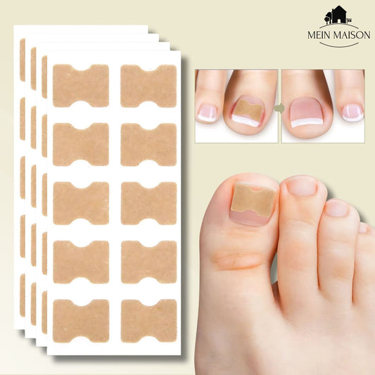 FixaNail – Correction indolore des ongles incarnés et déformés