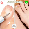 FixaNail – Correction indolore des ongles incarnés et déformés