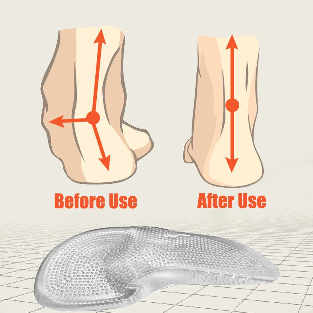 GELSTRIDE – Orthopädische Einlegesohlen aus Silikongel für ganztägigen Komfort 5