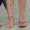 Sandalias Pylomo – Sandalias ortopédicas de verano para aliviar el dolor y mejorar la postura