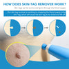 DERMASWIFT – Hautfleckenentferner gegen Warzen & Skin Tags