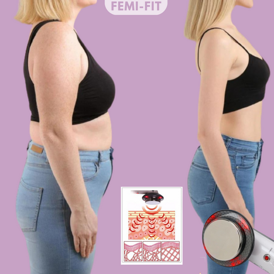 SlimShape – Quemador 3 en 1 de celulitis y grasa con EMS, ultrasonido y luz infrarroja