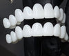 SmileFlex – Anpassbare Zahnprothese mit Dental-Linsen