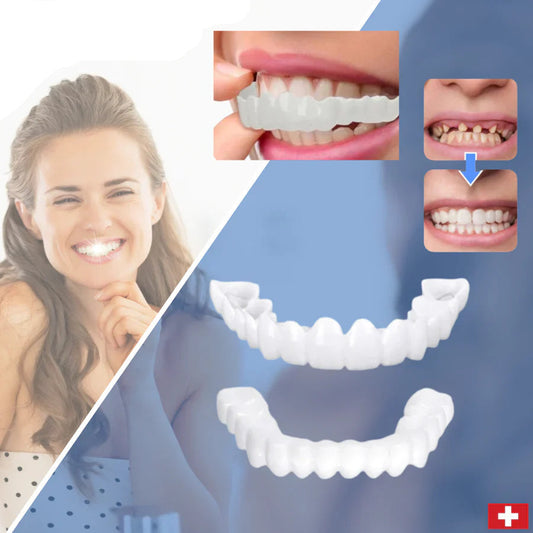 SnapFit – Restauración dental para una sonrisa blanca como el relámpago sin dentista