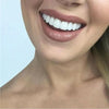 SnapFit – Restauración dental para una sonrisa blanca como el relámpago sin dentista