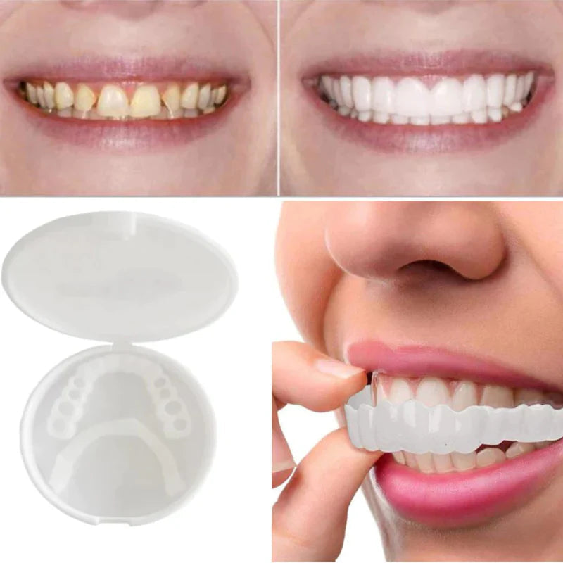 SnapFit – Restauración dental para una sonrisa blanca como el relámpago sin dentista